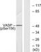 Vasodilator Stimulated Phosphoprotein antibody, TA312099, Origene, Western Blot image 