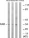 RRAD antibody, LS-C120027, Lifespan Biosciences, Western Blot image 