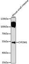Cytochrome P450 2W1 antibody, LS-C748790, Lifespan Biosciences, Western Blot image 