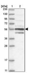 Makorin Ring Finger Protein 3 antibody, PA5-56170, Invitrogen Antibodies, Western Blot image 