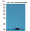 Diazepam Binding Inhibitor, Acyl-CoA Binding Protein antibody, STJ96564, St John