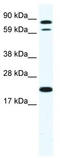 Zinc Finger Protein 287 antibody, TA329978, Origene, Western Blot image 