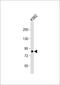 Spermatogenesis Associated 5 Like 1 antibody, 55-744, ProSci, Western Blot image 