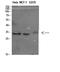 Nanos C2HC-Type Zinc Finger 1 antibody, STJ98619, St John