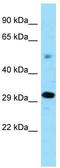 Protein Zfp202  antibody, TA343407, Origene, Western Blot image 