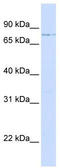 Plastin-2 antibody, TA335058, Origene, Western Blot image 