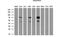 Glucokinase regulatory protein antibody, NBP2-03396, Novus Biologicals, Western Blot image 