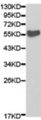 Autophagy Related 13 antibody, TA323903, Origene, Western Blot image 