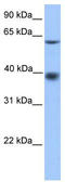 Major Facilitator Superfamily Domain Containing 4A antibody, TA337585, Origene, Western Blot image 