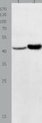 NFKB Inhibitor Delta antibody, TA322051, Origene, Western Blot image 