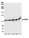 Glycyl-TRNA Synthetase antibody, A304-746A, Bethyl Labs, Western Blot image 