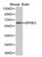 Sphingosine Kinase 2 antibody, abx002301, Abbexa, Western Blot image 