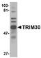 Tripartite motif-containing protein 30 antibody, orb75038, Biorbyt, Western Blot image 