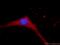 Potassium Calcium-Activated Channel Subfamily N Member 3 antibody, 17188-1-AP, Proteintech Group, Immunofluorescence image 