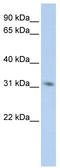 N-Methylpurine DNA Glycosylase antibody, TA336086, Origene, Western Blot image 