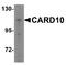 Caspase Recruitment Domain Family Member 10 antibody, A07686-1, Boster Biological Technology, Western Blot image 