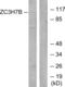 Zinc Finger CCCH-Type Containing 7B antibody, LS-C119305, Lifespan Biosciences, Western Blot image 