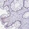 Chromosome 19 Open Reading Frame 73 antibody, PA5-64057, Invitrogen Antibodies, Immunohistochemistry frozen image 