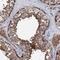 Phosphatidylserine Synthase 2 antibody, NBP2-38432, Novus Biologicals, Immunohistochemistry paraffin image 