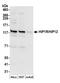 Huntingtin Interacting Protein 1 Related antibody, A304-806A, Bethyl Labs, Western Blot image 