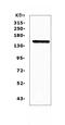 Fms Related Tyrosine Kinase 3 antibody, A00188-4, Boster Biological Technology, Western Blot image 