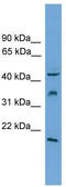 VH3 antibody, TA344410, Origene, Western Blot image 