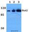 Signal Transducer And Activator Of Transcription 2 antibody, A01360-1, Boster Biological Technology, Western Blot image 