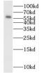 Myeloma Overexpressed antibody, FNab05466, FineTest, Western Blot image 