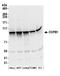 Coatomer Protein Complex Subunit Beta 1 antibody, A304-724A, Bethyl Labs, Western Blot image 