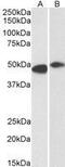 F-Box And Leucine Rich Repeat Protein 2 antibody, GTX17018, GeneTex, Western Blot image 