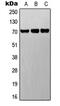 Delta/Notch Like EGF Repeat Containing antibody, GTX56019, GeneTex, Western Blot image 