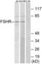Follicle Stimulating Hormone Receptor antibody, LS-C120657, Lifespan Biosciences, Western Blot image 
