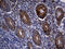 Mitochondrial import inner membrane translocase subunit Tim23 antibody, M09218, Boster Biological Technology, Immunohistochemistry paraffin image 
