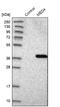 Mediator Complex Subunit 4 antibody, NBP1-84977, Novus Biologicals, Western Blot image 