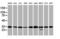 Proteasome Subunit Alpha 6 antibody, LS-C174613, Lifespan Biosciences, Western Blot image 