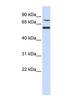 POC1 Centriolar Protein B antibody, NBP1-56307, Novus Biologicals, Western Blot image 