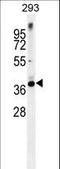 Syntaxin 16 antibody, LS-C161585, Lifespan Biosciences, Western Blot image 