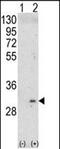 Integral Membrane Protein 2A antibody, PA5-49585, Invitrogen Antibodies, Western Blot image 
