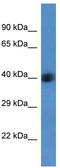 1-Acylglycerol-3-Phosphate O-Acyltransferase 3 antibody, TA343065, Origene, Western Blot image 