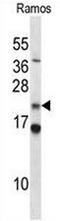 COP9 Signalosome Subunit 8 antibody, AP51025PU-N, Origene, Western Blot image 
