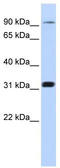 Metal transporter CNNM4 antibody, TA338406, Origene, Western Blot image 
