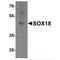 SRY-Box 18 antibody, TA349079, Origene, Western Blot image 