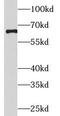 Eukaryotic Translation Initiation Factor 2A antibody, FNab02689, FineTest, Western Blot image 