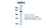 Zinc Finger Protein 93 antibody, PA5-43089, Invitrogen Antibodies, Western Blot image 