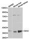 Growth Arrest Specific 2 antibody, TA326966, Origene, Western Blot image 
