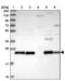 Peroxiredoxin 3 antibody, NBP2-38486, Novus Biologicals, Western Blot image 