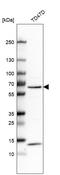 Carnitine O-Acetyltransferase antibody, HPA019230, Atlas Antibodies, Western Blot image 