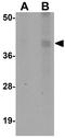 Calcium Homeostasis Modulator 1 antibody, GTX85207, GeneTex, Western Blot image 