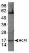 C-C Motif Chemokine Ligand 2 antibody, TA336723, Origene, Western Blot image 