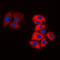 MOK Protein Kinase antibody, LS-C352758, Lifespan Biosciences, Immunofluorescence image 